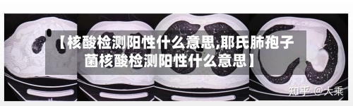 【核酸检测阳性什么意思,耶氏肺孢子菌核酸检测阳性什么意思】