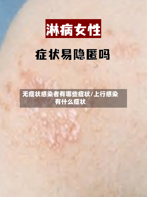 无症状感染者有哪些症状/上行感染有什么症状