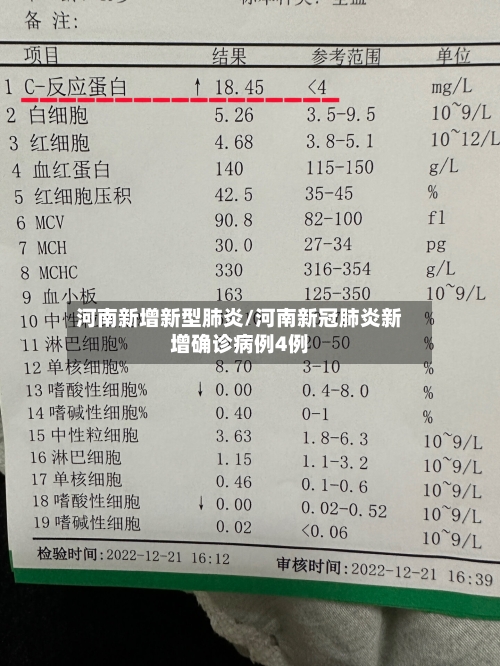 河南新增新型肺炎/河南新冠肺炎新增确诊病例4例